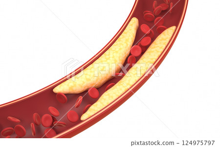 clinical, micro, pathology 124975797