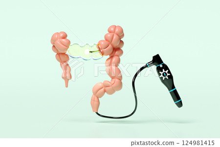 Colonoscopy to find the cause of disease isolated on green background. check digestive, intestine health concept, 3d illustration render Colonoscopy to find the cause of disease isolated on green background. check digestive, intestine health concept, 3d illustration render 124981415