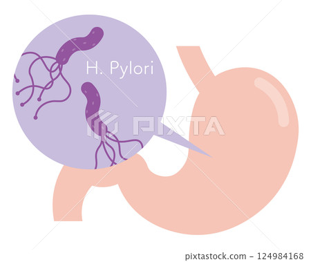 Helicobacter pylori illustration 124984168
