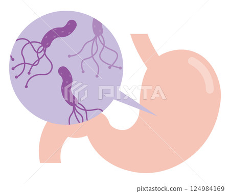 Helicobacter pylori illustration 124984169