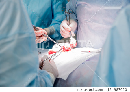 Surgeon and assistants in operating room with surgery equipment. Surgeon and assistants in operating room with surgery equipment. 124987020