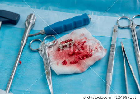 Laminectomy equipment on the surgical table. Medical background Laminectomy equipment on the surgical table. Medical background 124987115