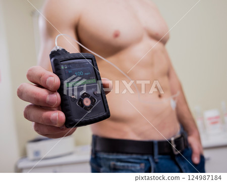 Diabetic man with an insulin pump connected in his abdomen Diabetic man with an insulin pump connected in his abdomen 124987184