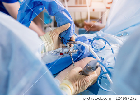 Arthroscope surgery. Orthopedic surgeons in teamwork in the operating room  124987252