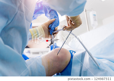 Arthroscope surgery. Orthopedic surgeons in teamwork in the operating room  124987311