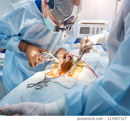 Spinal surgery. Group of surgeons in operating room with surgery equipment. Spinal surgery. Group of surgeons in operating room with surgery equipment. 124987327