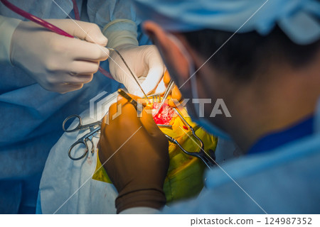 Brain surgery. Group of surgeons in operating room with surgery equipment. Brain surgery. Group of surgeons in operating room with surgery equipment. 124987352