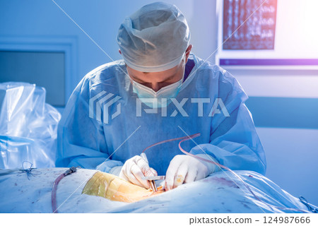 Spinal surgery. Group of surgeons in operating room with surgery equipment. Spinal surgery. Group of surgeons in operating room with surgery equipment. 124987666
