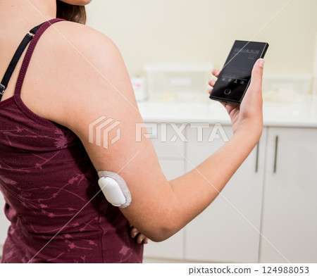 Medical device for glucose check. Continuous glucose monitoring pod.  124988053