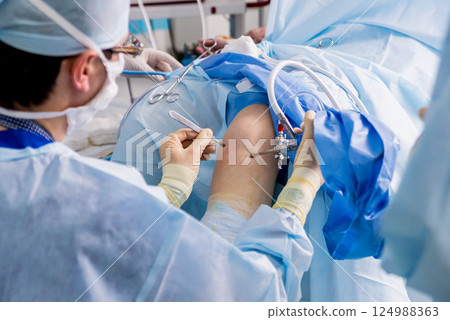Arthroscope surgery. Orthopedic surgeons in teamwork in the operating room Arthroscope surgery. Orthopedic surgeons in teamwork in the operating room 124988363