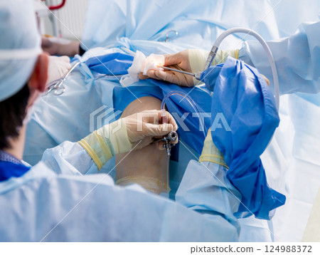 Arthroscope surgery. Orthopedic surgeons in teamwork in the operating room Arthroscope surgery. Orthopedic surgeons in teamwork in the operating room 124988372