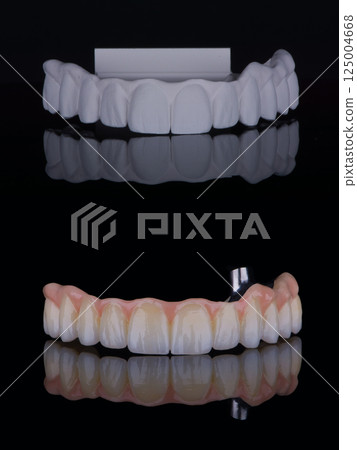 Two stages of making full dental zirconium prosthesis on titanium bar. Dental care concept. Two stages of making full dental zirconium prosthesis on titanium bar. Dental care concept. 125004668