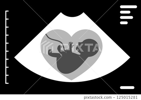 Ultrasound scan showing baby silhouette inside heart shape Ultrasound scan showing baby silhouette inside heart shape 125015281