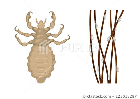 Head louse and nits clinging to hair strands causing pediculosis Head louse and nits clinging to hair strands causing pediculosis 125015287