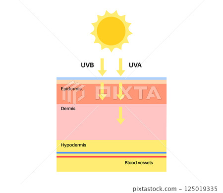 Skin damage from sunburn 125019335