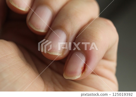 Close-up of a woman's hand nails without manicure. Clean hands 125019392