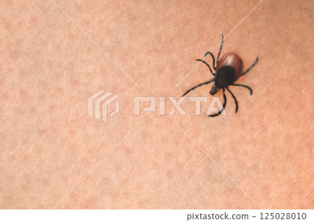 Tick on the skin, close up 125028010