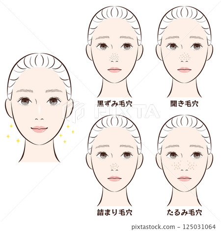 鼻毛孔困擾4種套裝 |皮膚鬆弛、阻塞、黑頭、毛孔粗大的插圖素材 鼻毛孔困擾4種套裝 |皮膚鬆弛、阻塞、黑頭、毛孔粗大的插圖素材 125031064