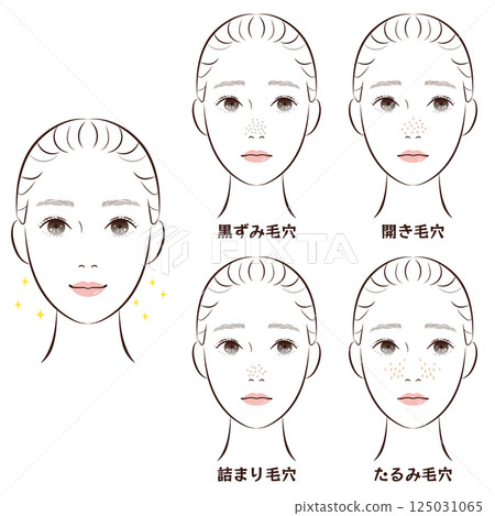 鼻毛孔困擾4種套裝 |皮膚鬆弛、阻塞、黑頭、毛孔粗大的插圖素材 125031065