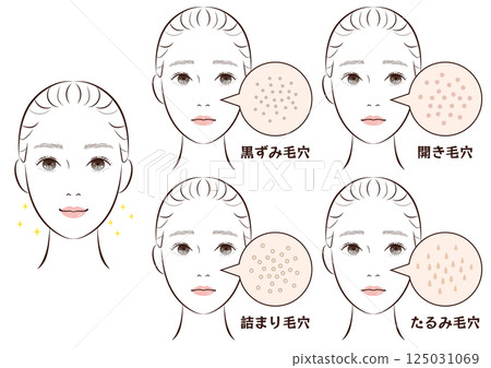 Nose pore trouble 4 types set | Illustration material of sagging, clogged, blackheads, and open pores Nose pore trouble 4 types set | Illustration material of sagging, clogged, blackheads, and open pores 125031069