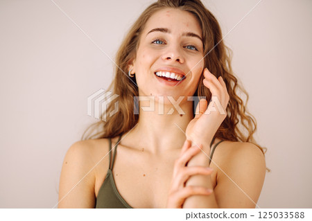 Portrait of a beautiful woman with inflammations on the skin of her face. Medicine and cosmetology. 125033588