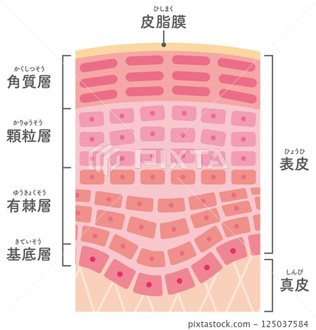 發炎皮膚的橫切面圖示（帶名稱） 125037584