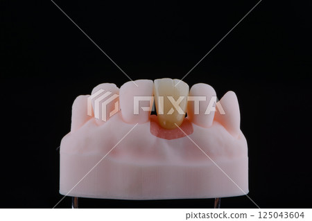 Mirror copy of central maxillary incisor, zirconia crown on titanium abutment fixed on printed model Mirror copy of central maxillary incisor, zirconia crown on titanium abutment fixed on printed model 125043604