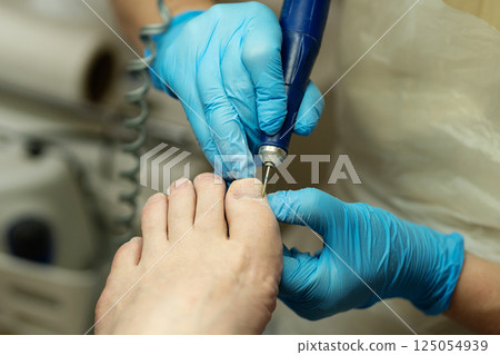 Footcare specialist uses electric device to treat toenails with precision. Footcare specialist uses electric device to treat toenails with precision. 125054939