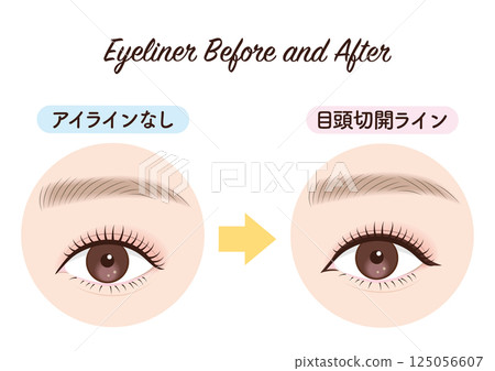 Eyeliner before and after eye incision line Eyeliner before and after eye incision line 125056607