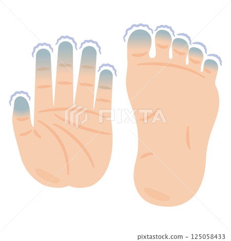 Illustration of cold feet and hands 125058433