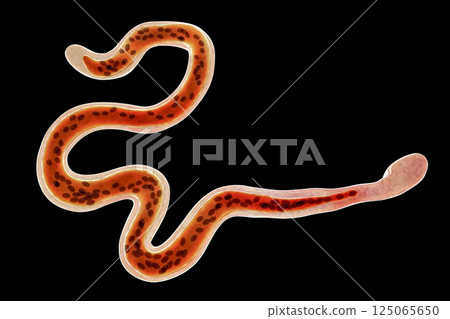 Brugia malayi, a roundworm nematode 125065650