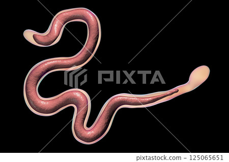 Brugia malayi, a roundworm nematode 125065651
