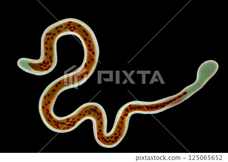 Brugia malayi, a roundworm nematode 125065652