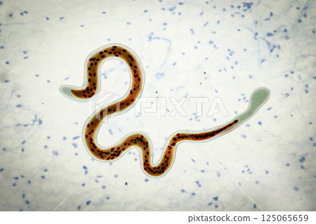 Brugia malayi, a roundworm nematode 125065659