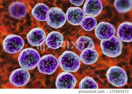 Burkitt's lymphoma cells, is a cancer of the lymphatic system Burkitt's lymphoma cells, is a cancer of the lymphatic system 125065672