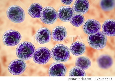 Burkitt's lymphoma cells, is a cancer of the lymphatic system 125065673