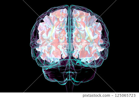 Human brain with highlighted white matter, 3D illustration Human brain with highlighted white matter, 3D illustration 125065723