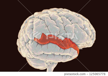 Human brain with highlighted superior temporal gyrus 125065778