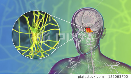 Neurons, brain cells, located in the pons Varolii of the human brain Neurons, brain cells, located in the pons Varolii of the human brain 125065790