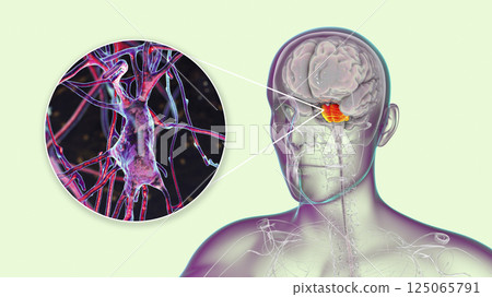 Neurons, brain cells, located in the pons Varolii of the human brain Neurons, brain cells, located in the pons Varolii of the human brain 125065791