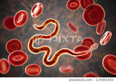 Brugia malayi, a roundworm nematode Brugia malayi, a roundworm nematode 125065856