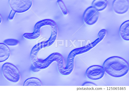 Brugia malayi in blood, a roundworm nematode 125065865