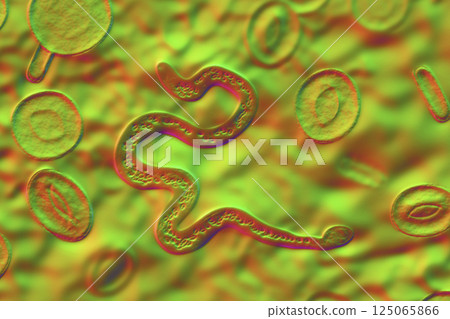 Brugia malayi in blood, a roundworm nematode 125065866