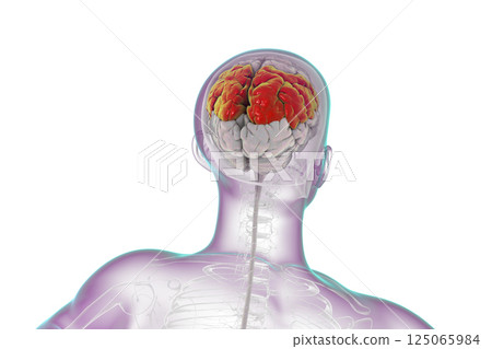 Human brain with highlighted parietal lobe Human brain with highlighted parietal lobe 125065984