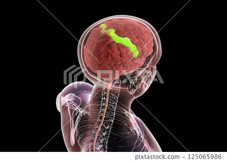 Human brain in body with highlighted postcentral gyrus Human brain in body with highlighted postcentral gyrus 125065986