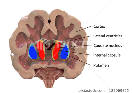 Coronal section of a healthy brain showing normal anatomy of basal baglia and ventricles 125069835