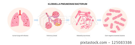 Klebsiella pneumoniae poster 125083386
