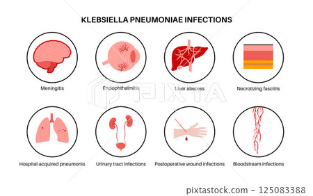 Klebsiella pneumoniae poster 125083388