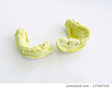 Dental Oral Stone Model 125087293