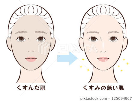 Before and after of dull skin and clear skin 125094967